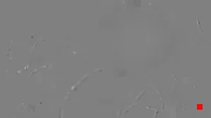 Caméra IP - TH