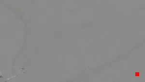Caméra IP - ES