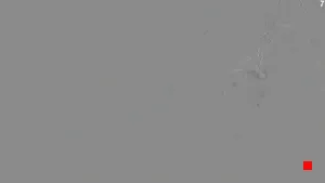 Caméra IP - ES