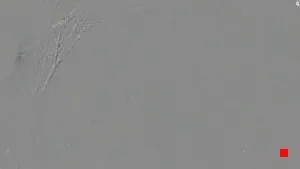 Caméra IP - ES