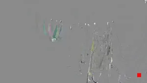 Caméra IP - IT